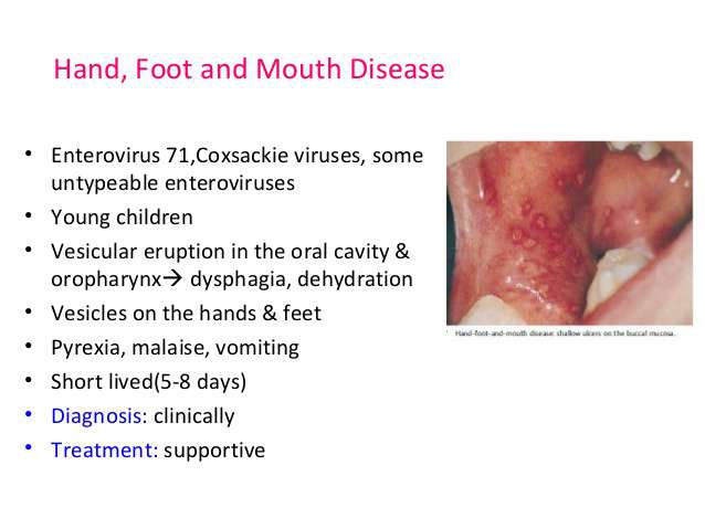 أمراض الفيروسات المعوية عند الأطفال و الرضع