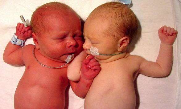 ارتفاع هيموجلوبين الدم عند الأطفال حديثي الولادة