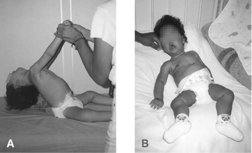 الأمراض العصبية العضلية عند الأطفال و الرضع