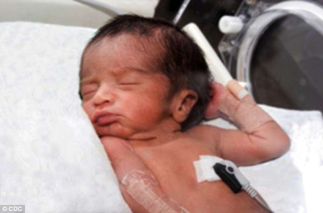 الايدز عند الجنين و حديث الولادة