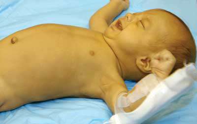 التهابات الأطفال حديثي الولادة