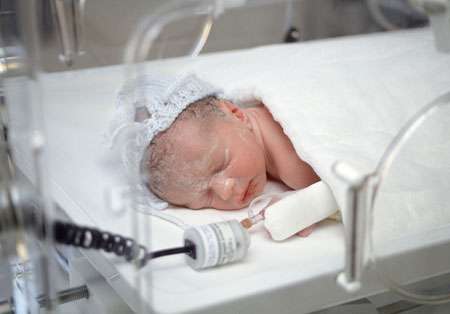 الخداج :اسباب الخداج , اعراض الخداج , علاج الخداج