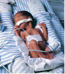 انتان و تلوث الدم عند الطفل المولود حديث الولادة