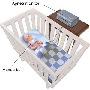 انقطاع و ضيق التنفس عند الأطفال حديثي الولادة