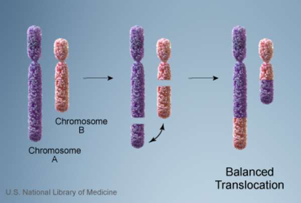 خلل الكروموسومات عند الأطفال و علاجه