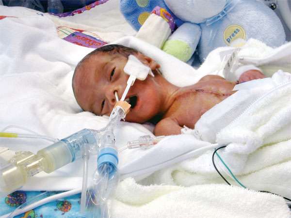 داء الاغشية الهلامية الهيالينية عند الخديج و حديث الولادة