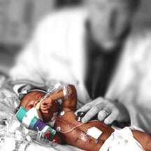 مرض الطفل المولود حديث الولادة