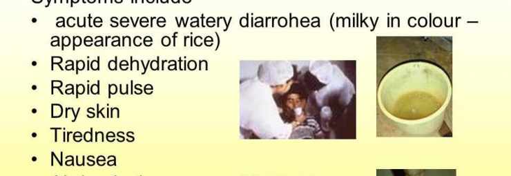أعراض الكوليرا