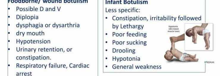 اعراض التسمم الوشيقي عند الرضع