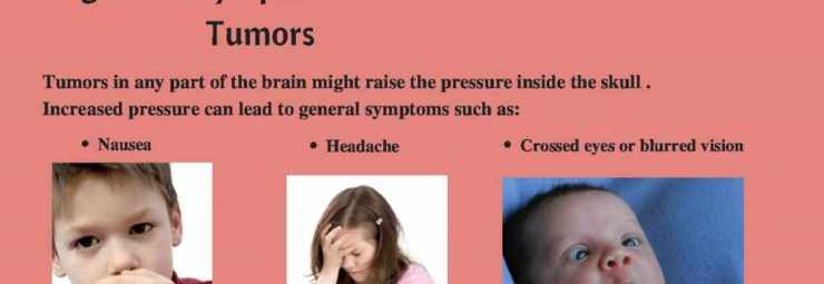 اعراض سرطان الدماغ عند الاطفال