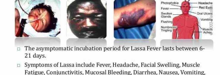 اعراض فيروس ارينا و حمى لاسا