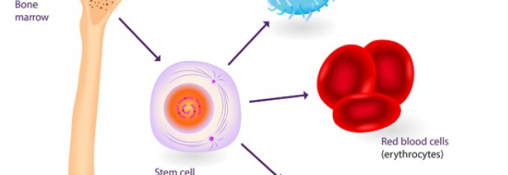 الآثار المتأخرة لزرع الخلايا الجذعية