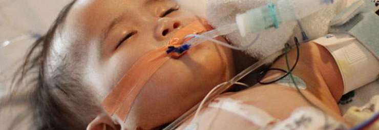 الفشل و القصور التنفسي عند الأطفال و الرضع