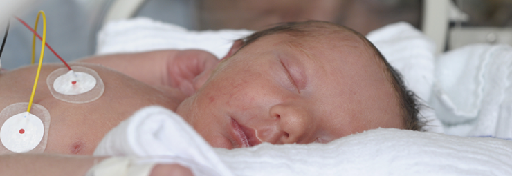 الوقاية من تسمم الدم بالقولونيات عند الاطفال حديثي الولادة