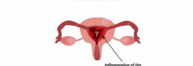 التهاب الرحم للحامل