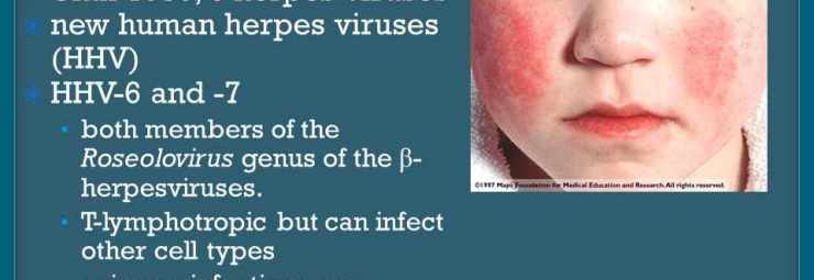 فيروس الهربس البشري نوع 6 و 7